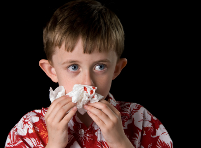 Unit 8 - A Nose Bleeding
