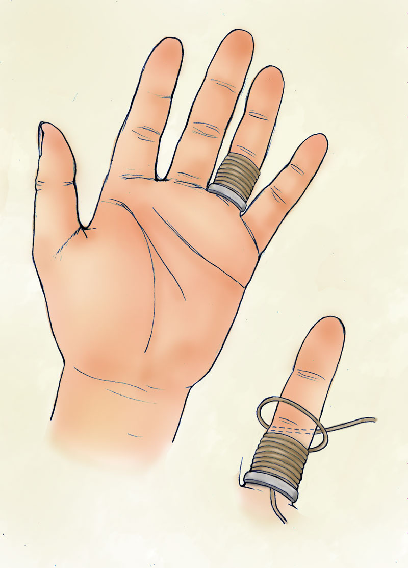 Unit 7 - A Stuck Ring